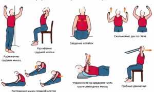 Комплекс упражнений при остеохондрозе позвоночника