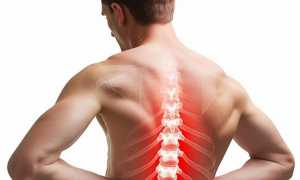 Боль в пояснице при наклоне вперед