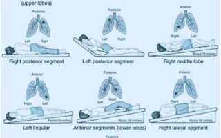 Дыхательные упражнения при бронхите и пневмонии