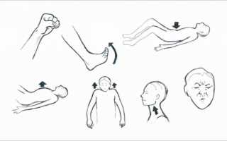 Нервно-мышечная релаксация по Джекобсону