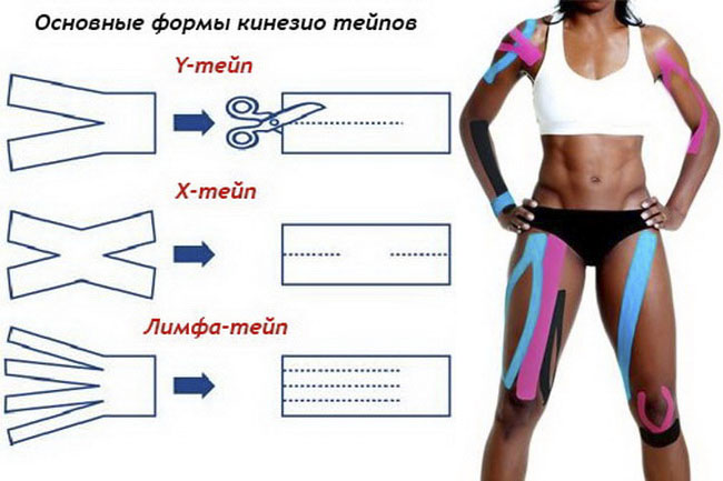 Основные аппликации кинезиотейпирования