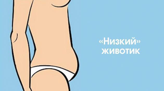 Форма живота при лишнем весе: фартук, карман, кошелёк